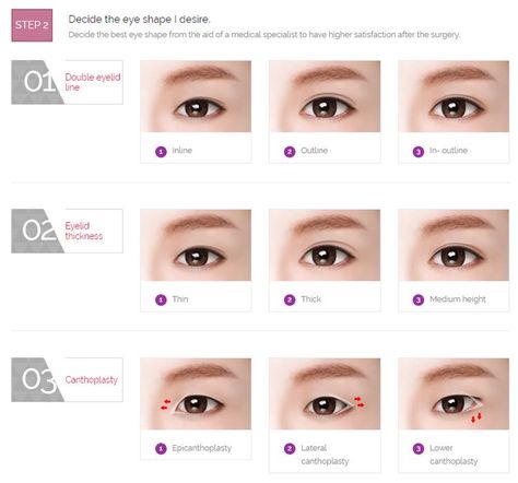 Korean Eye Shape, Asian Double Eyelid, Eyelid Cream, Plastic Surgery Korea, Double Eyeliner, Plastic Surgery Clinic, Silver Eyeliner, Overnight Beauty Hacks, Korean Lip Tint