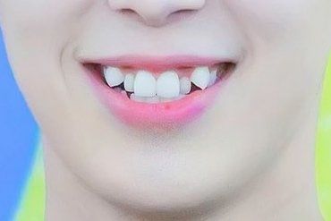 verivery- yeonho smile teeth Yeonho Verivery Smile, Sharp Teeth Smile Drawing Reference, How To Draw Smiles With Teeth, Toothy Smile Drawing Reference, Showing Teeth Pose, Yaeba Teeth, Teeth Reference, Chou Skin, Verivery Yeonho