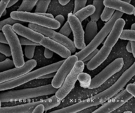 Kingdom Monera: unicellular organisms without a nucleus; includes Domains: Bacteria & Archaea