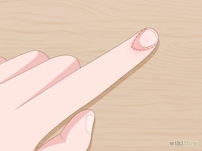 How to Grow Your Nail Beds -- via wikiHow.com Cute Nail Polish Designs For Short Nails, Short Nails For Small Nail Beds, Nail Designs For Short Nail Beds, Nail Beds Health, How To Grow Almond Nails, Growing Out Natural Nails, Nail Ideas For Small Nail Beds, Short Nails For Short Nail Beds, Long Nail Beds Short Nails