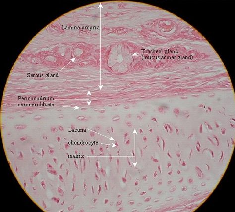 This tissue is located at the ends of bones and on the rings of the trachea. It provides strength, sturcture, and protection. Hyaline Cartilage, Histology Slides