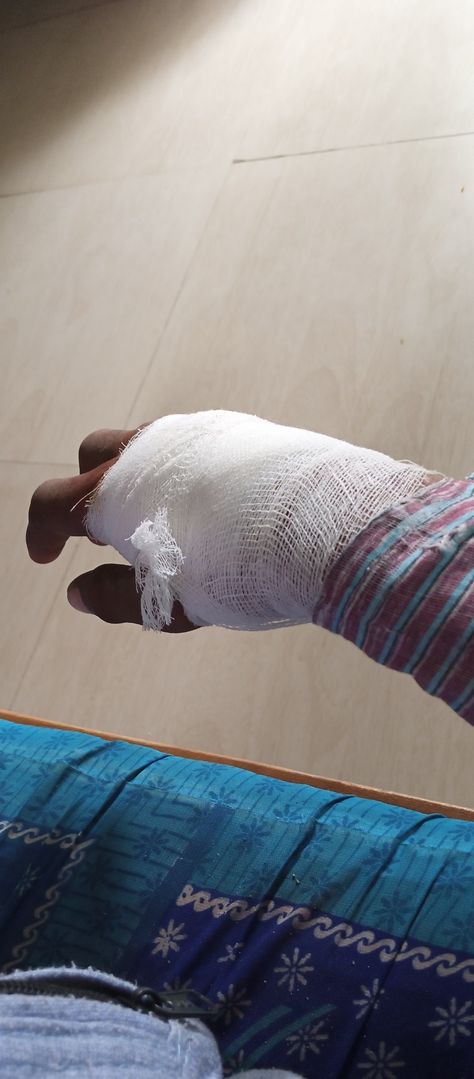 Fractured Hand Pic, Rakul Preet Singh Saree, St Bus, Attitude Bio, Hospital Admit, Radha Beauty, Attitude Bio For Instagram, Night Rides Snapchat, Hospital Admit Hand Pics