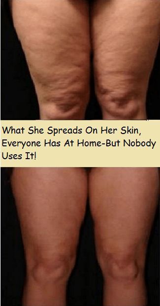 WHAT SHE SPREADS ON HER SKIN, EVERYONE HAS AT HOME Homemade Face Masks, Homemade Face, Skin Complexion, Herbal Remedies, Spreads, Home Remedies, Beauty Health, Healthy Skin, Health Tips