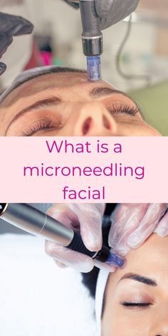 Micronidelling Face, Layers Of The Skin, Spa Facials, Microneedling Pen, Esthetician Business, Micro Needling, Skin Advice, Facial Toning, Beauty Clinic