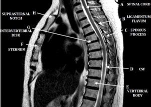 MRIQuiz.com - MRI Registry Study Guide & 17.5 CE Credits Mri Study Guide, Mentor Ohio, Radiology Student, Brain Images, Rainbow City, Ct Scan, Study Program, Study Guides, Radiology