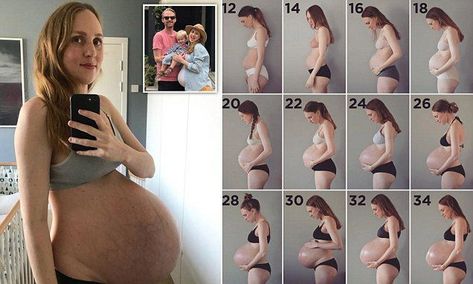 Mother pregnant with TRIPLETS shares extraordinary week-by-week photos Triplet Baby Bump, Twin Belly Progression, Twin Bump Progression, Triplets Pregnancy Belly, 3 Month Baby Bump, 30 Weeks Pregnant Belly, Pregnant With Triplets Belly, 3 Months Pregnant Belly, 4 Months Pregnant Belly