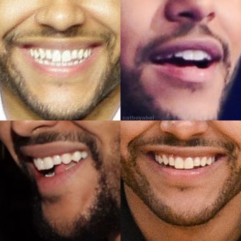 The Weeknd Bunny Teeth, Bunny Teeth Smile Girl, Bunny Teeth Aesthetic, Bunny Teeth Smile, The Weeknd Clothes, The Weeknd Drawing, Smile Tips, Bunny Teeth, The Weeknd Background