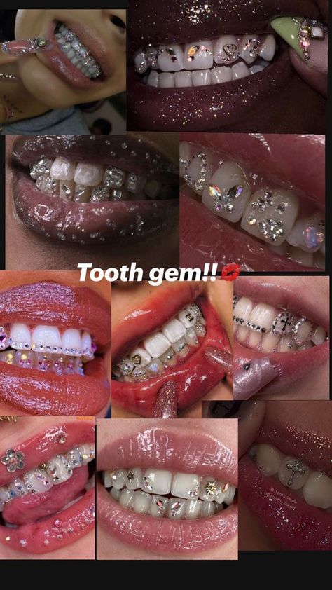 Body Jewelry Diy, Pretty Teeth, Dental Jewelry, Grillz Teeth, Diamond Teeth, Dope Jewelry Accessories, Grills Teeth, Tooth Gem, Teeth Jewelry