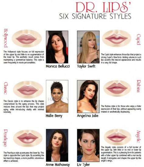 9/10 Lips? drkhawar.com I don't even know. #braces #braces #transformation Types Of Lips, Lip Inspiration, Beauty Surgery, Cosmetic Injector, Lips Ideas, Dermal Fillers Lips, Plumped Lips, Juvederm Lips, Makeup Book