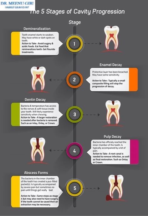 Dental Pictures, Dental Assistant Study, Oral Health Education, Remedies For Tooth Ache, Dental Health Care, Kedokteran Gigi, Dental Hygiene School, Dental Fun, Dental Facts