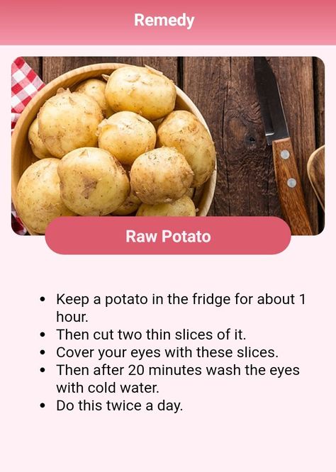 Potato For Dark Circles, Under Eye Dark Circles, Eye Dark Circles, Raw Potato, Remove Dark Circles, Healthy Juice Recipes, Dark Circles Under Eyes, Dark Circle, Healthy Detox