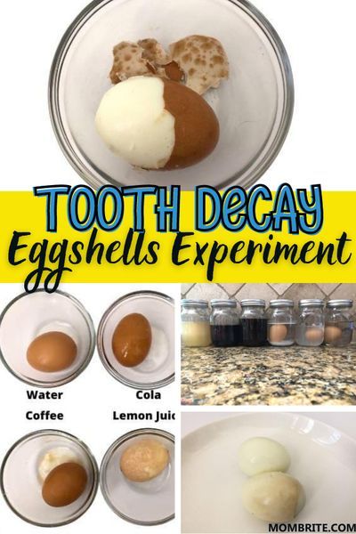 Health Classroom, Kids Science Experiment, Egg Experiment, Safety Activities, Egg Experiments, Learning Log, Tooth Cavity, Library Crafts, Coffee Soda