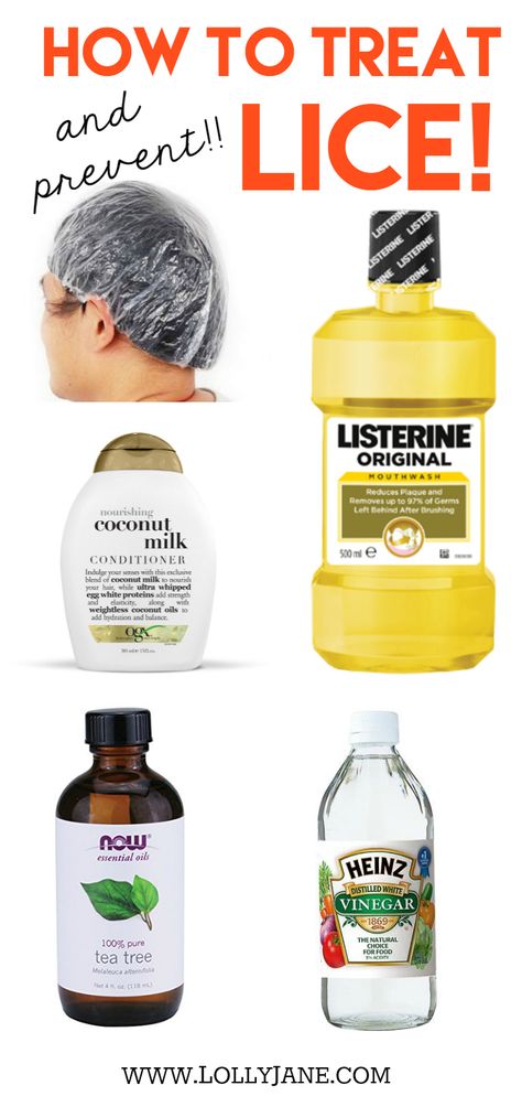 How to treat lice!! How to prevent lice! You may have all of these household items laying around your home. Safeguard yourself and kids before they invade! How to treat and prevent lice! Vinegar Tea, How To Treat Lice, Lice Remedies, Coconut Milk Conditioner, Lice Prevention, Lice Removal, Now Essential Oils, Coconut Shampoo, Oil Coconut