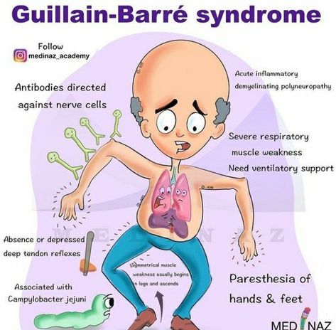 Guillain-Barre Syndrome #medicalschool #resources #medicalstudent - Image Credits: Eman Salah Visual Learner, Guillain Barre, Guillain Barre Syndrome, Medical Mnemonics, Nursing School Essential, Nursing School Motivation, Medical School Life, Nurse Study Notes, Basic Anatomy And Physiology