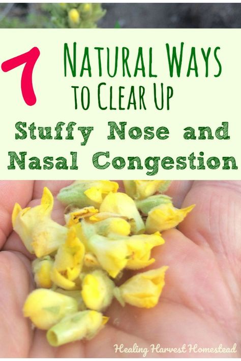 Here are seven natural ways you can get rid of congestion fast! Find out how to stop your stuffy nose so you can breathe again. Sinus congestion is no fun, and these are easy home remedies that really work to help stop nasal congestion in its tracks and unclog your poor stuffed up nose. Get Rid Of Congestion Fast, Remedy For Sinus Congestion, Natural Remedies For Congestion, Chest Congestion Remedies, Congestion Remedies, Sinus Remedies, Home Remedies For Sinus, Natural Decongestant, Stuffy Nose Remedy