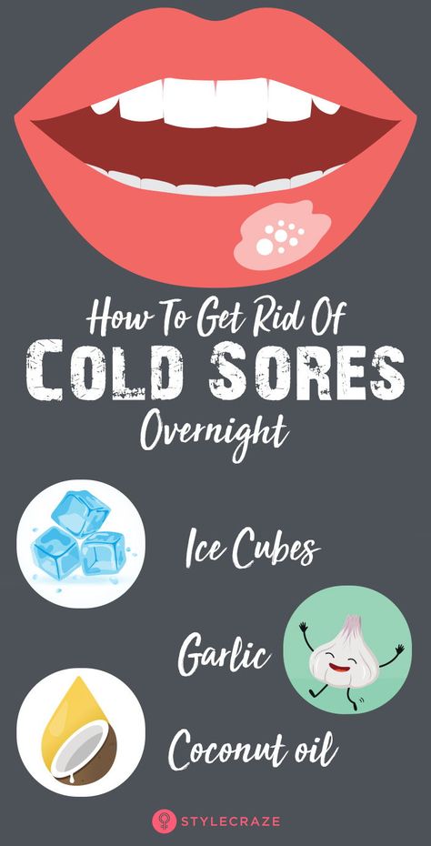 Cold Sore Remedy Fast, Cold Sore Remedy Overnight, Fever Blister Remedy, Cold Sore Lip, Blister Remedies, Blister On Lip, Get Rid Of Cold, Fever Blister, Cold Sores