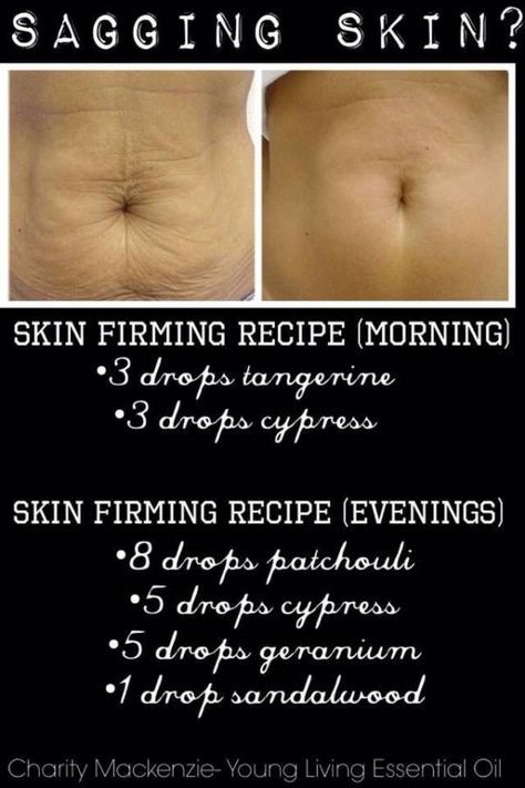 Is sagging skin a problem for you? Then try using these Essential oils to see a… Healing Essential Oils, Essential Oils Guide, Essential Oils Health, Home Remedies For Acne, Essential Oil Blends Recipes, Essential Oils For Skin, Living Essentials Oils, Essential Oil Diffuser Blends, Young Living Oils