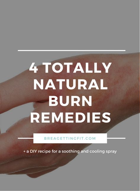 How To Heal Burned Skin, How To Heal A Burn Quickly, Burn Relief Skin, Burn Remedies, Curling Iron Burn, Spikenard Essential Oil, Burn Remedy, Burn Relief, How To Heal Burns