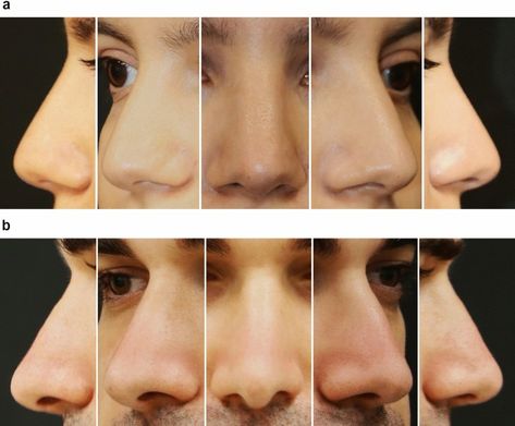 Noses From The Side, Hooked Nose Reference, 360 Face Reference, Flat Nose Reference, Nose All Angles, Ear Pointing, Covering Ears Reference, Nose Perspective, Roman Nose Front View