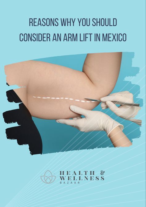 Don’t you like the look and shape of your arms? Do you think they are too thick and undefined? Currently, countless patients seek to reshape the appearance of their arms after losing a lot of weight or for genetic reasons through an arm lift in Mexico since this will allow them to eliminate excess skin and achieve the slim beautiful arms they have always wanted. #aesthetic #bodycare #surgeryclinic Exercise After Sleeve Surgery, Arm Lift Surgery Before And After, How To Prepare For Rotator Cuff Surgery, Excess Skin Removal Surgery, Thyroid Surgery Scar, Arm Lift Surgery, Under Arm Fat, Skin Removal Surgery, Lipo Suction