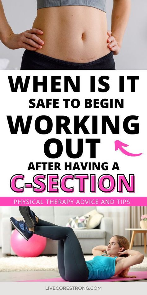 You just had a cesarean birth and you want to know when it is safe to begin working out after a C-section.You are absolutely determined to have a smooth recovery. Exercise is definitely a part of your postpartum journey goals, and now it’s time to figure out what is safe and what is not safe to do for your postpartum workout. This physical therapist and a mom of 4 answers all your C-section postpartum workout questions here in this article. Click to continue. After C Section Exercise, Exercise For Post C Section, Workout For Postpartum, Postpartum Workout For C Section, Postpartum C Section Workout Plan, Post C Section Workouts, Postpartum Workout After C Section, Postnatal Workout C Section, Work Out After C Section