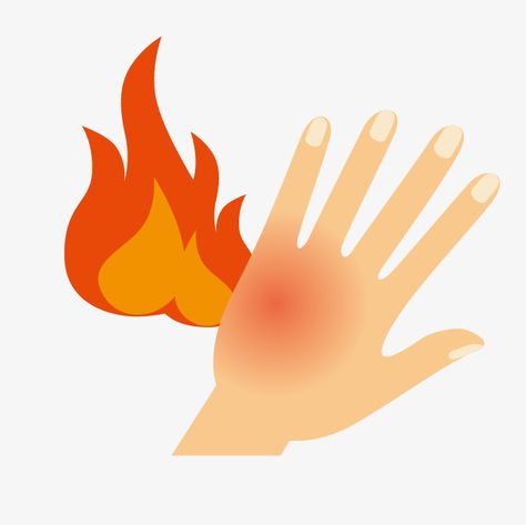 Hand Burns Skin, 3rd Degree Burns, Burn Care, Chemical Burn, Burn Injury, Images Cartoon, Burning Body, Hand Clipart, Degree Burns