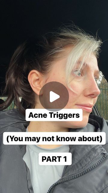 35 likes, 2 comments - lifewithkaraolivia on January 30, 2024: "Acne Triggers Part 1 ✨ Save & Sceenshot 📸 to refer back to if needed! Our bodies are so co..." Acne Triggers, Healing Acne, Bad Acne, The Bigger Picture, Bigger Picture, Acne Marks, My Skin, Our Body, The Things