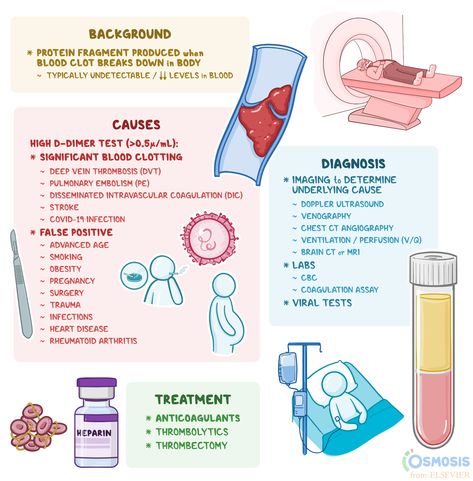 D Dimer Test, Disseminated Intravascular Coagulation, D Dimer, Iv Fluids, Mri Scan, Acute Care, Chest Pain, Allah Islam, Blood Test