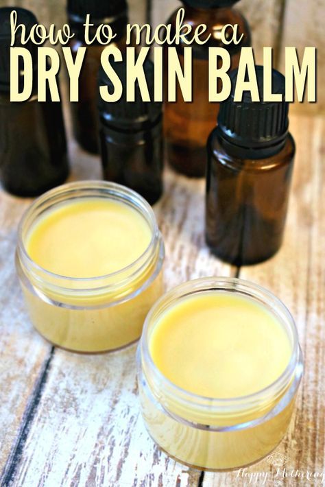 Dry Skin Diy, Balm Recipe, Skin Care Routine For 20s, Extremely Dry Skin, Skin Balm, Diy Kosmetik, Natural Healing Remedies, Avon Products, Perfectly Posh