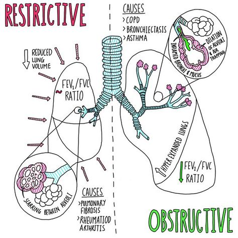 Image result for restrictive vs obstructive lung diseases Lungs Notes, Respiratory Therapy Notes, Respiratory Therapist Student, Respiratory Therapy Student, Medical Student Study, Pulmonology, Nursing School Survival, Respiratory Care, Respiratory Therapy