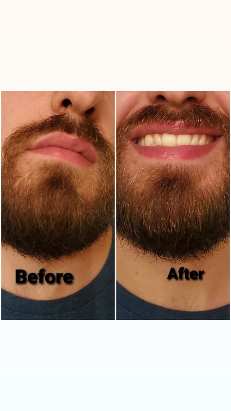 MK Men Beard Oil Before and After Men Beard, Beard Oil, Bearded Men, Mary Kay