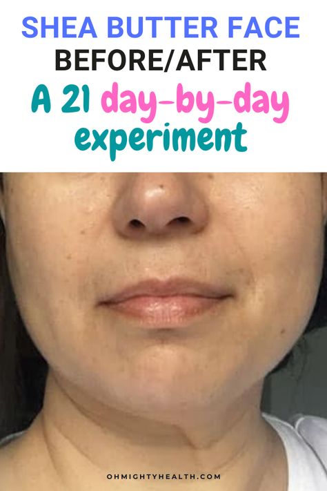 I applied shea butter on my face at night for 21 days. I documented the daily changes and took some photos. Have a look, see what you think. Shea butter is a great natural ingredient. #sheabutter #sheabutteronface #sheabutterbeforeafter #naturalskincare #naturaloils #naturalbutters Essential Oils For Wrinkles, Oils For Wrinkles, Shae Butter, Shea Butter Face, Shea Butter Recipes, Shea Butter Benefits, Homemade Wrinkle Cream, Nutrition Food, Raw Shea Butter