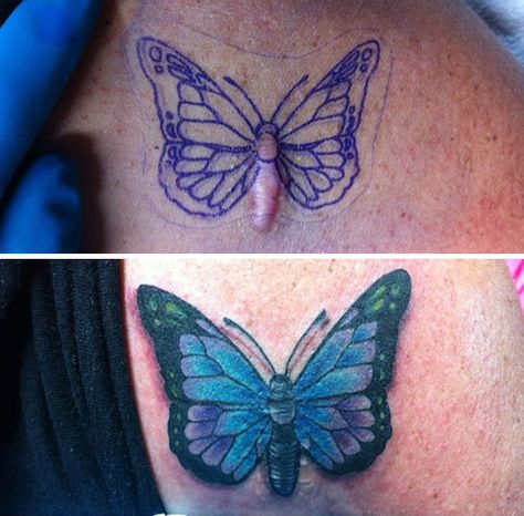 10+ Amazing Tattoos That Turn Scars Into Works Of Art Keloids Tattoo Cover Up, Scar Tattoo Cover Up, Scar Cover Up Tattoo, Scars Tattoo, Butterfly Tattoo Cover Up, Cover Up Tattoos For Women, Henne Tattoo, Tattoo Over Scar, Scar Cover Up