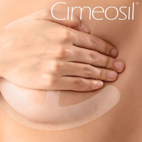 This is our CimeosilÂ® Gel Sheeting in the Breast Reduction Shape (also referred to as the âAnchorâ shape). This is designed to reduce scarring of typical incisions that result from breast reduction or reconstructive surgery. #cimeosil #scar #scars #scarring #scarred #flatten #fade #skin #beauty #aesthetics #breast #breastreduction #breastreconstruction #reconstruction #surgery #surgeon #plasticsurgery #plasticsurgeon #cosmeticsurgery #cosmeticsurgeon Breast Reduction Surgery, Fade Skin, Reduction Surgery, Breast Reconstruction, Reconstructive Surgery, Breast Reduction, Scarring, Plastic Surgeon, Cosmetic Surgery