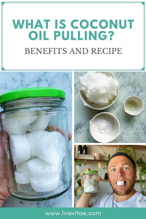 Coconut Oil Pulling Benefits, Coconut Pulling, Teeth Remedies, Oil Pulling Benefits, Coconut Oil For Teeth, Coconut Oil Skin Care, Teeth Whitening Diy, Coconut Oil Pulling, Coconut Oil Uses