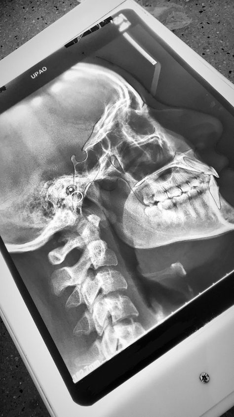 #odontologia Dental Xrays, Dental Wallpaper, Quick Saves