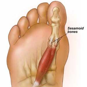 Frankincense Oil Uses, Sesamoid Bone, Tomato Nutrition, Calendula Benefits, Coconut Benefits, Matcha Benefits, Joints Pain Relief, Foot Pain, Pain Relief