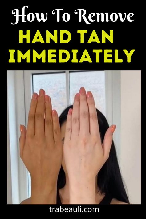 Hand Tan At Home Immediately How To Get Rid Of Sun Tan On Face, Hands Tan Removal At Home, Remedy For Tanned Hands, How To Remove Tan From Hand And Face, How To Remove Hand Hair, How To Remove Skin Tanning, Tan Remove From Hands, How To Remove Hand Tanning, Anti Tanning Remedies