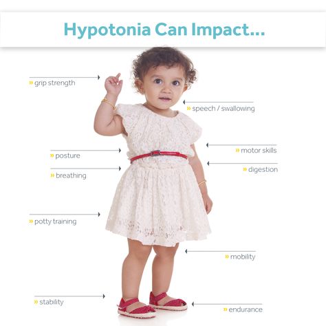 Hypotonia Baby, Baby Developmental Milestones, Occupational Therapist Assistant, Prader Willi Syndrome, Low Muscle Tone, Teeth Diseases, Occupational Therapy Assistant, Pediatric Physical Therapy, Occupational Therapy Activities