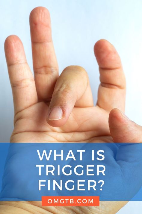 Click here to learn more about Trigger Finger Trigger Finger Exercises, Hand Therapy Exercises, Knee Pain Relief Exercises, Joints Pain Remedy, Finger Exercises, Trigger Finger, Hand Exercises, Knee Pain Relief, Hand Therapy