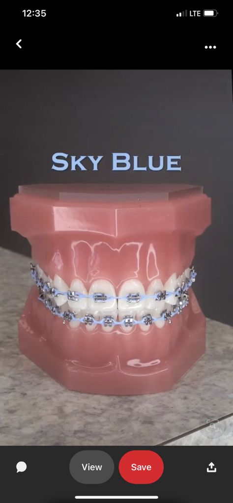 Braces Light Blue, Nice Braces Colors, Green Braces On Black People, Periwinkle Braces, Baby Blue Braces, Light Purple Braces, Baby Pink Braces, Powerchain Braces Color, Sky Blue Braces