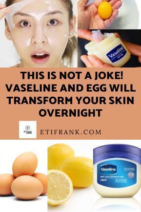 skin care #BrownSpotsInSkinFolds Clear Skin Face Face Skin Care Face Face Beauty Tips For Glowing Vaseline Uses For Face, Face Wrinkles Remedies, Wrinkles Remedies Face, Natural Facial Mask, Vaseline Uses, Wrinkle Remedies, Natural Face Skin Care, Skin Care Wrinkles, Beauty Tips For Glowing Skin