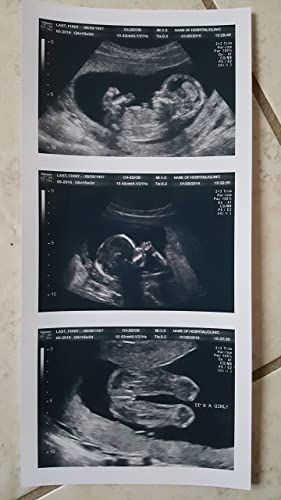 Ultrasound Prank, Fake Ultrasound, Baby Ultrasound Pictures, Arte Ganesha, Girl Scout Troop Leader, Pregnancy Ultrasound, Ultrasound Technician, Baby Ultrasound, Ultrasound Tech