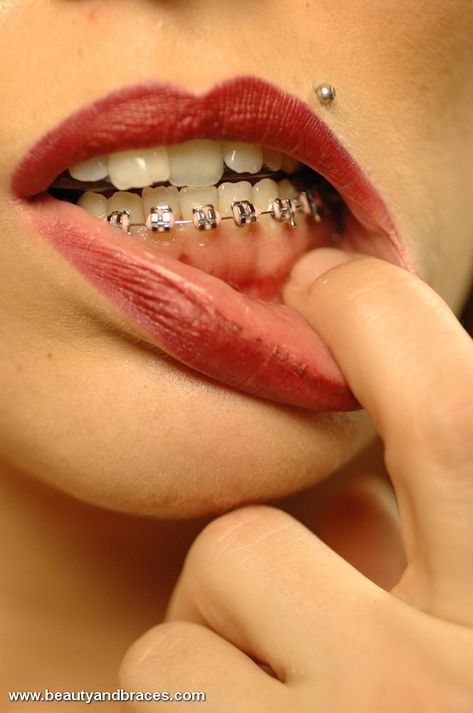 Bottom Braces Only, Bottom Braces, Tooth Braces, Adult Braces, Brace Face, Dental Braces, Perfect Teeth, Red Lips, Braces