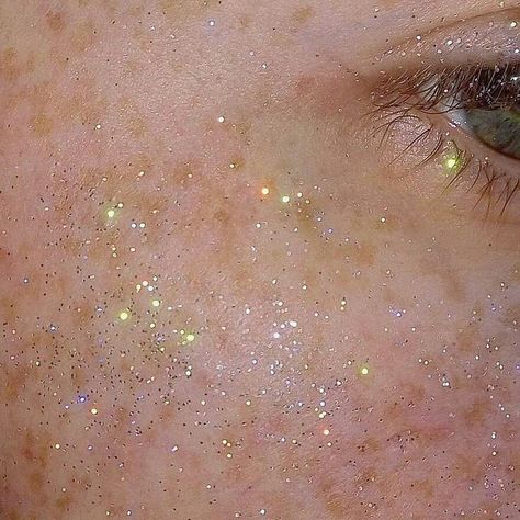 Star Freckles Aesthetic, Freckle Constellation, Freckle Aesthetic, Glowing Freckles, Constellation Freckles, Constellations Aesthetic, Constellation Aesthetic, Star Freckles, Gold Freckles