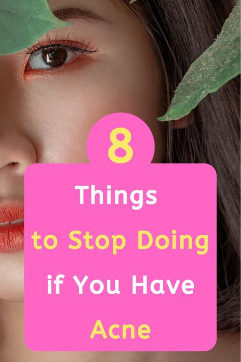 Things To Stop Doing, Acne Hacks, Forehead Acne, Acne Prone Skin Care, Prevent Pimples, Rid Of Acne, Natural Acne Remedies, How To Get Rid Of Pimples, Acne Problem