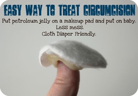 Treating a circumcision without the mess--works for both disposables and cloth diapers Cloth Diapering Newborn, Petroleum Jelly, Cloth Diapering, Newborn Clothes, Newborn Care, Baby Time, Baby Tips, Baby Health, Baby Life