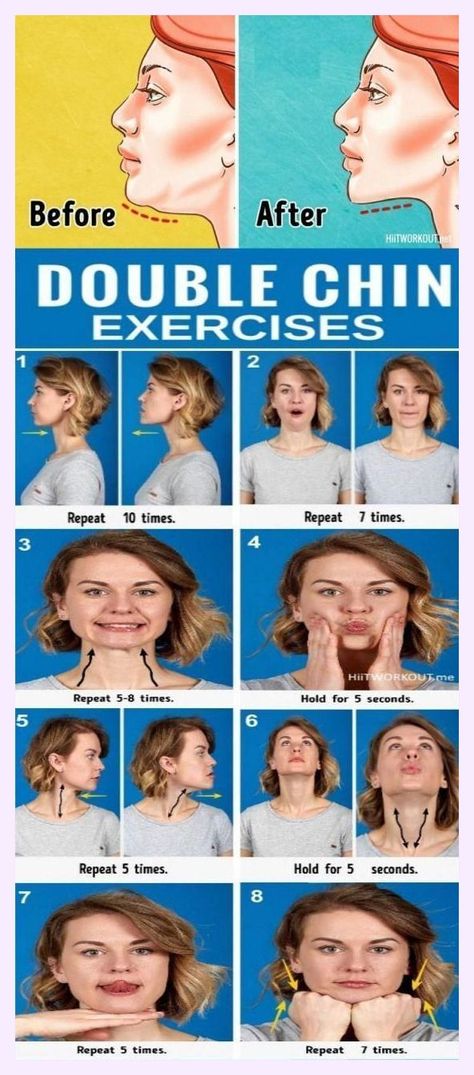 Double Chin Removal, Face Fat Loss, Double Chin Exercises, Chin Exercises, Slim People, Saggy Skin, Chubby Cheeks, Fat Loss Workout, Double Chin