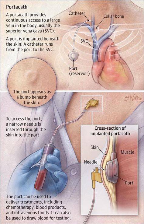 Nursing Cheat, Cardiac Nursing, Nursing School Survival, Oncology Nursing, Nursing School Studying, Nursing School Tips, Medical School Studying, Nursing School Notes, Phlebotomy