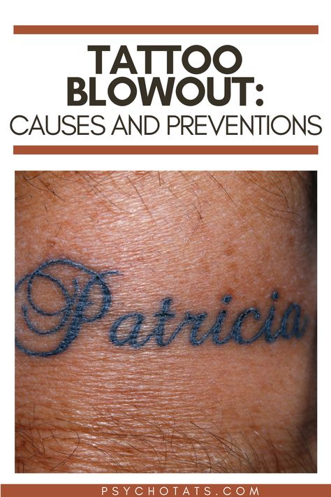 Tattoo Blowout Real Recognize Real Tattoos, Blown Out Tattoo, Tattoo Fixes, Tattoo Guide, Common Tattoos, Tattoo Cover-up, Up Tattoos, Name Tattoos, Word Tattoos